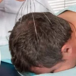 Head Massager Benefits